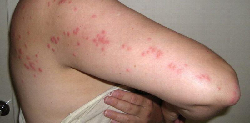 как вывести клопов из дивана самостоятельно